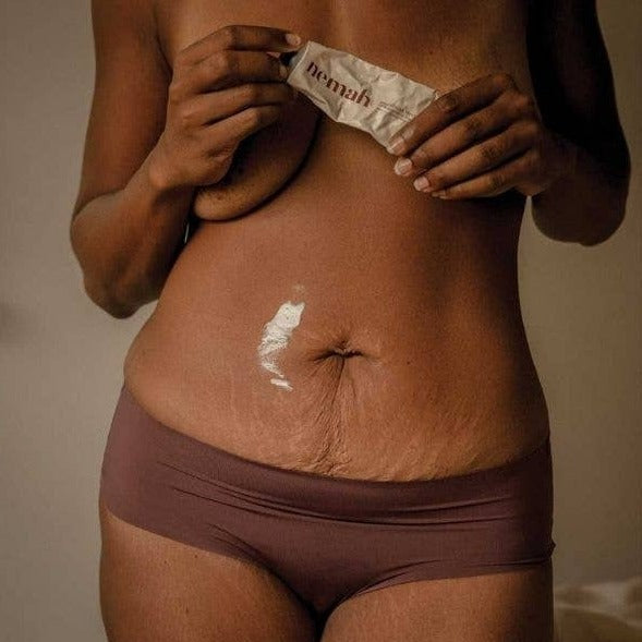 Revitalizing Stretch Mark Cream
